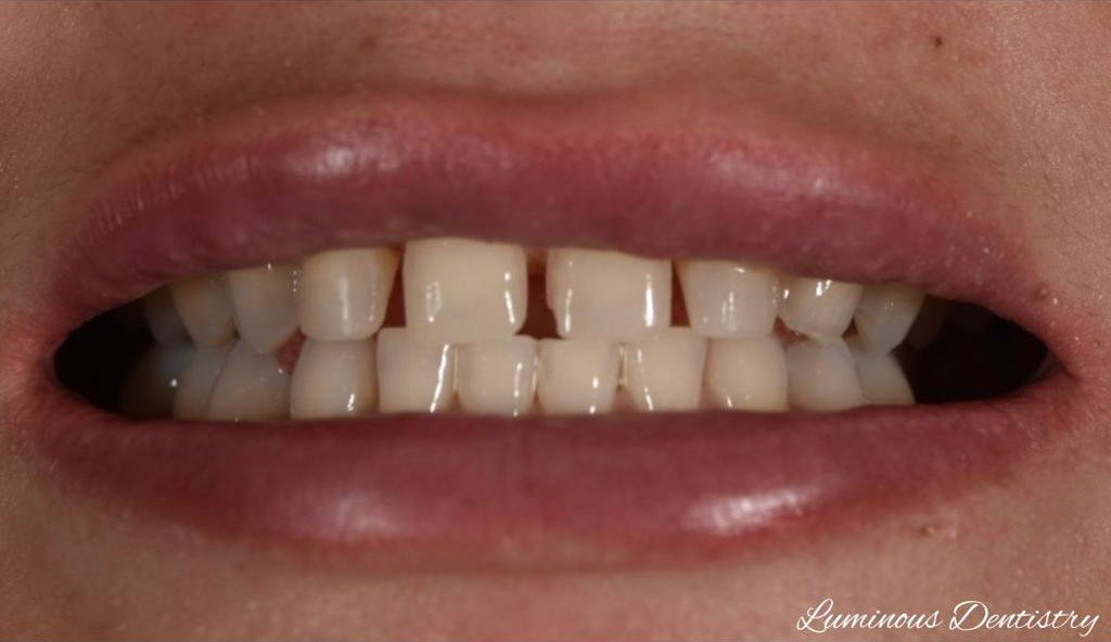 Before Image