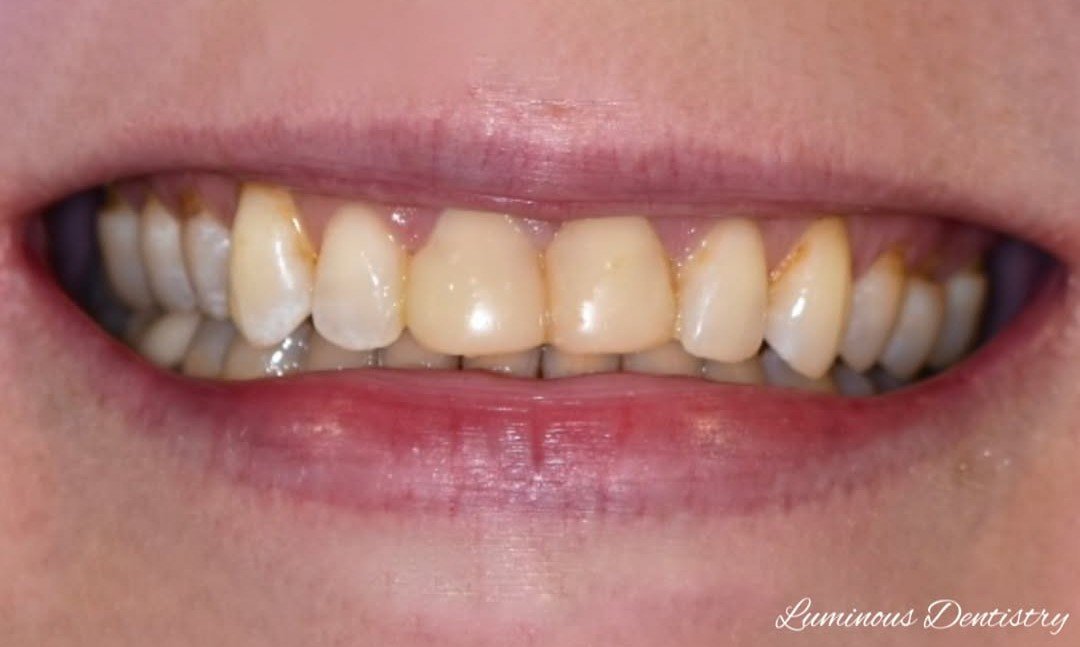 Before Image