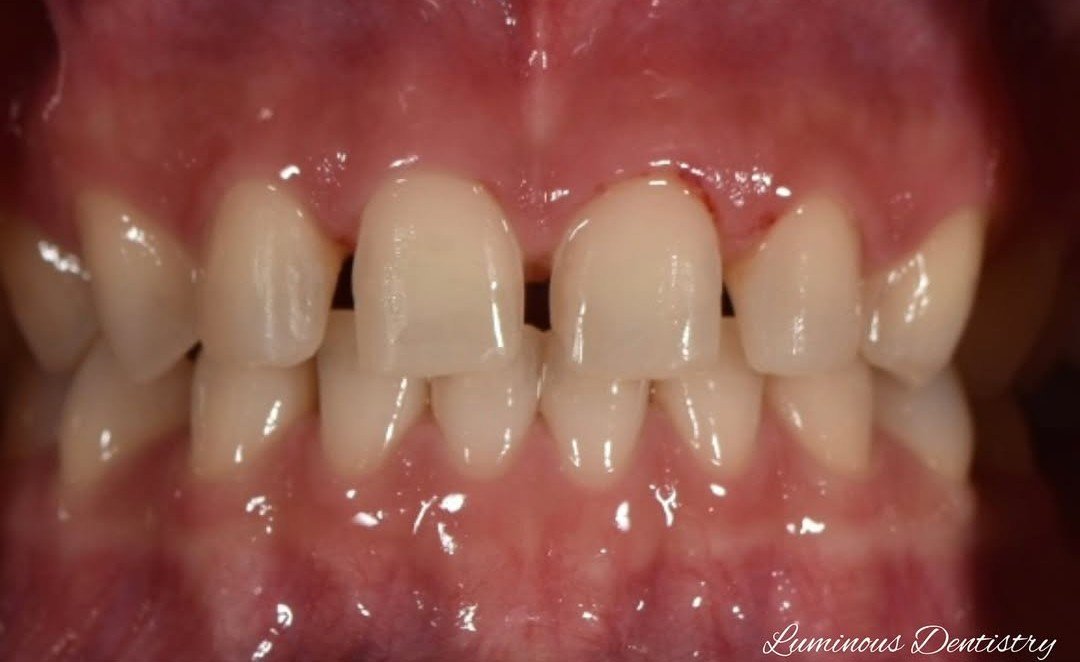 Before Image